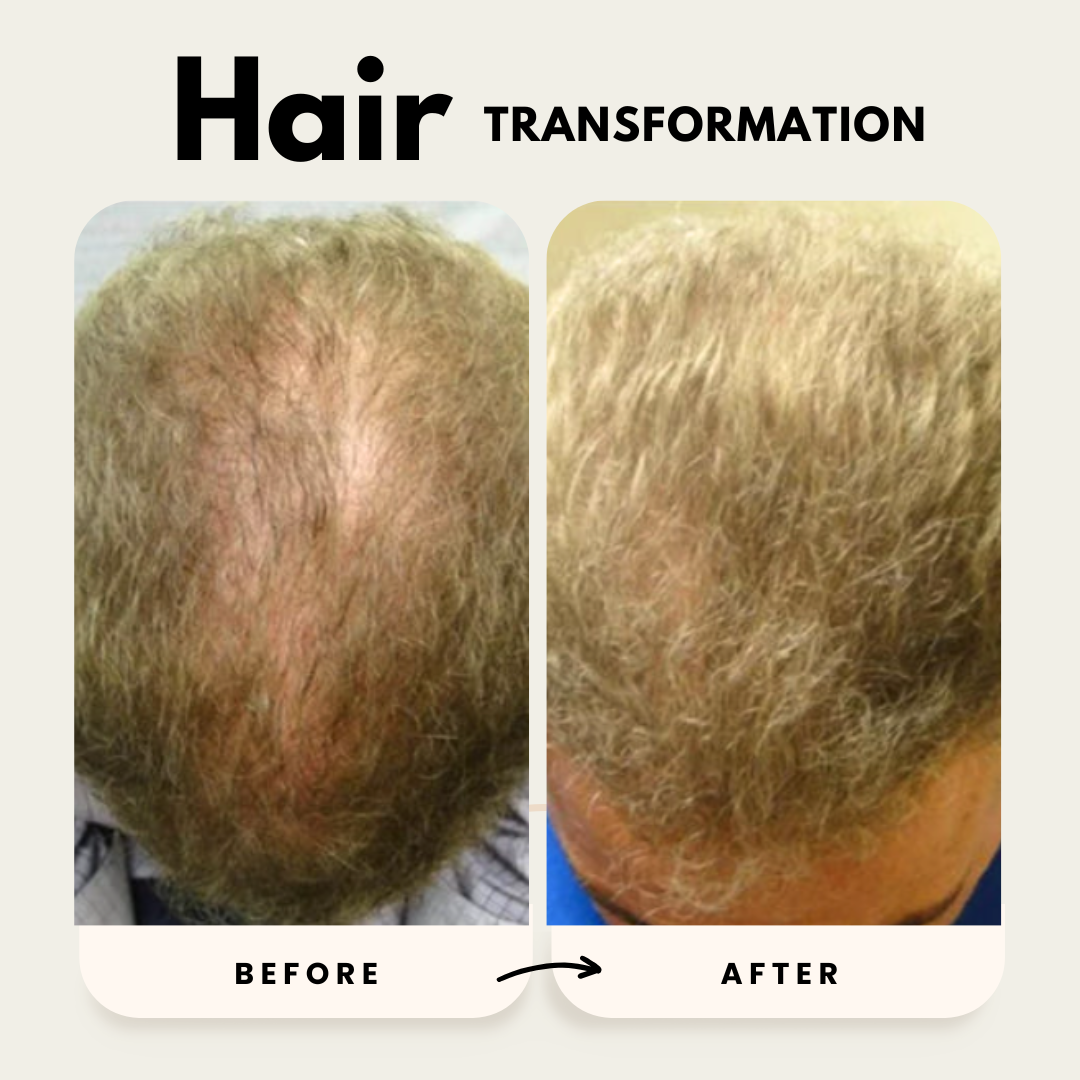 Lustrao Hair Growth Trio| Consistency Kit-4