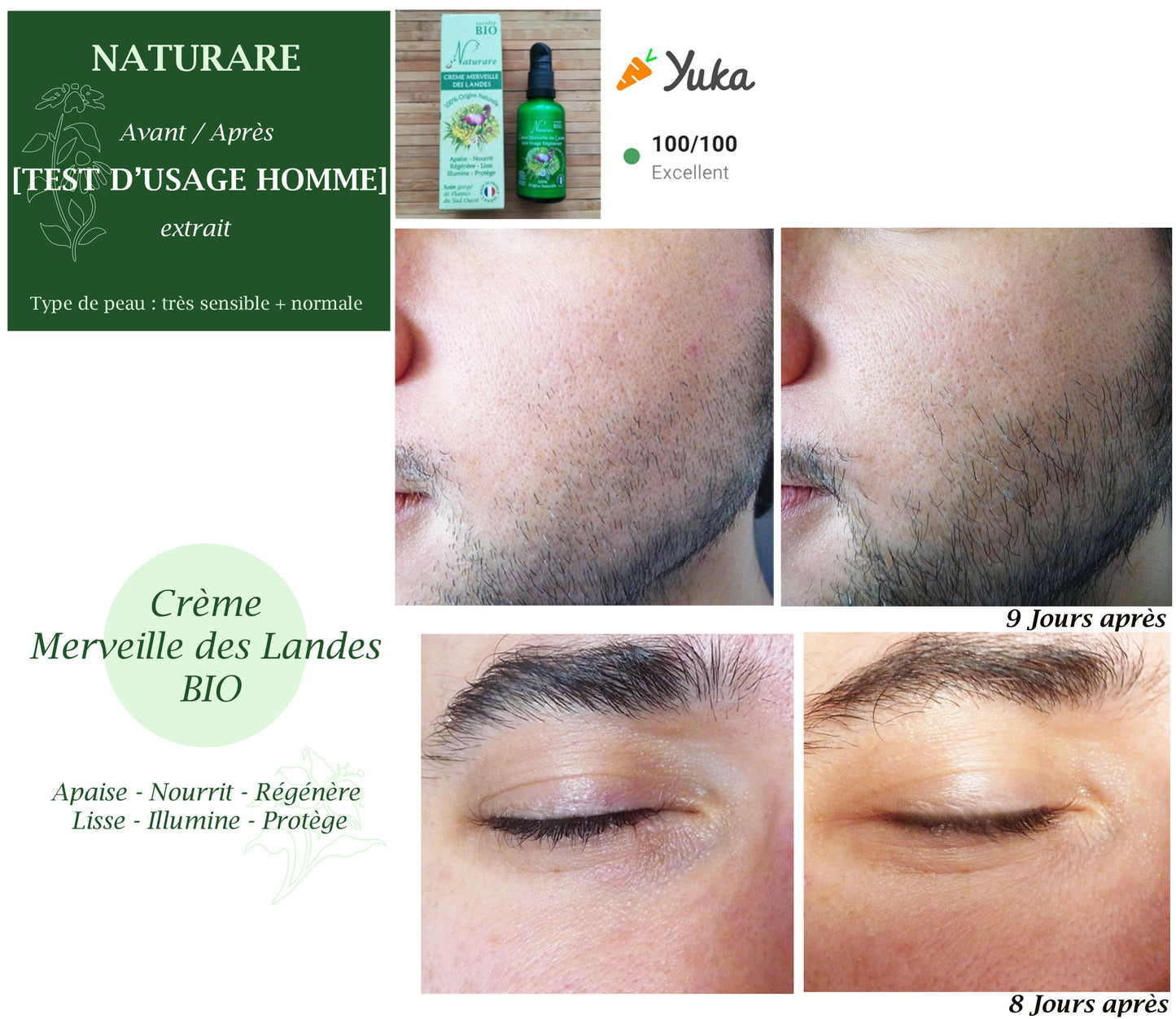 Before and after comparison of a skincare product on a man's face with visible results.