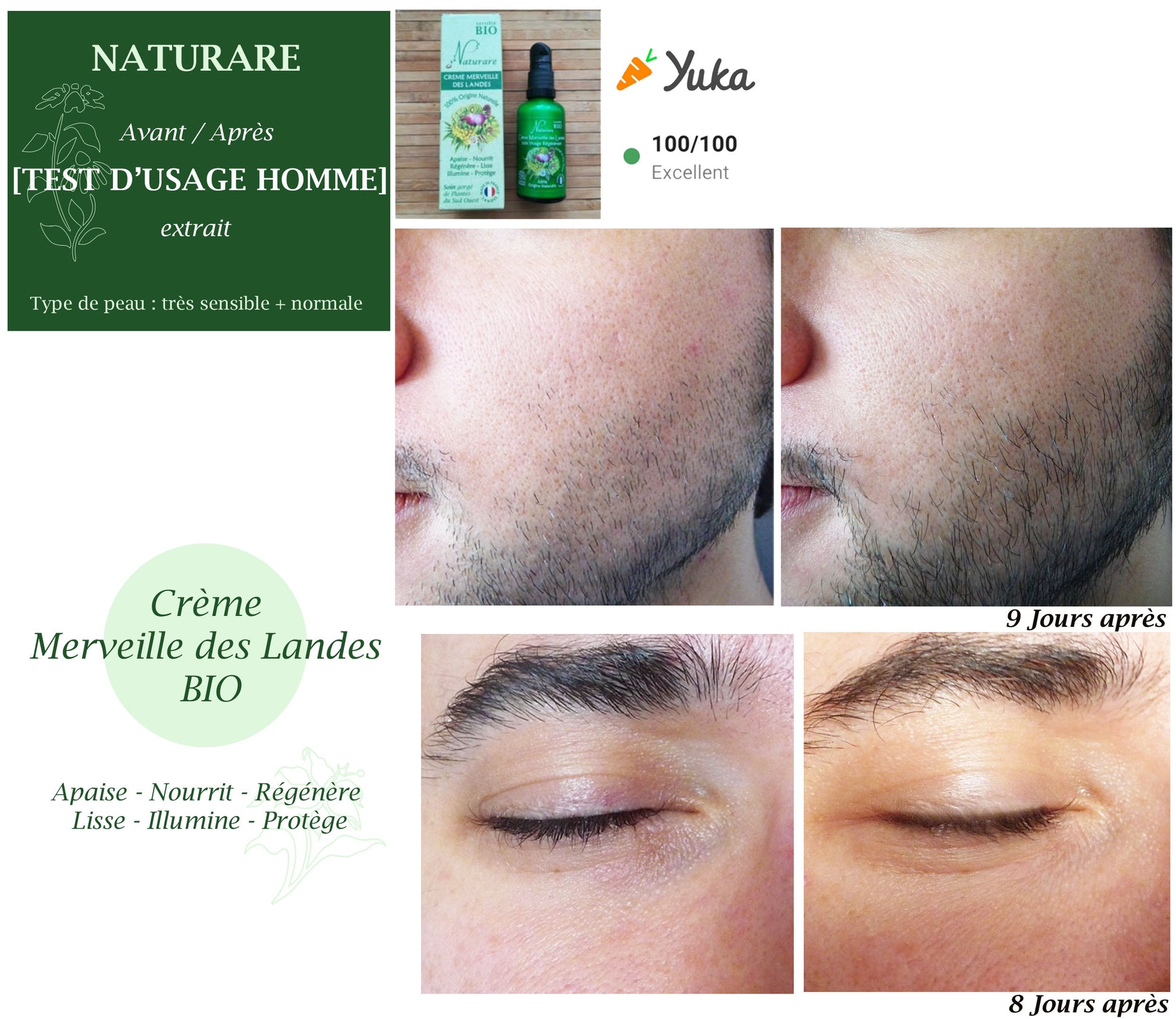 Before and after comparison of a skincare product on a man's face with visible results.