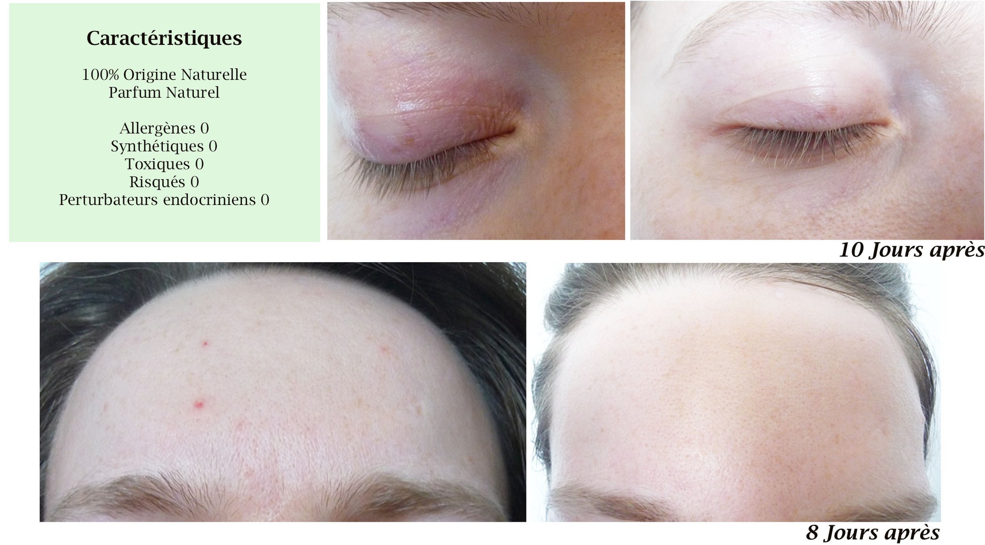 Before and after effects of a skincare product on skin with text detailing natural origin, no allergens, synthetics, or endocrine risks.