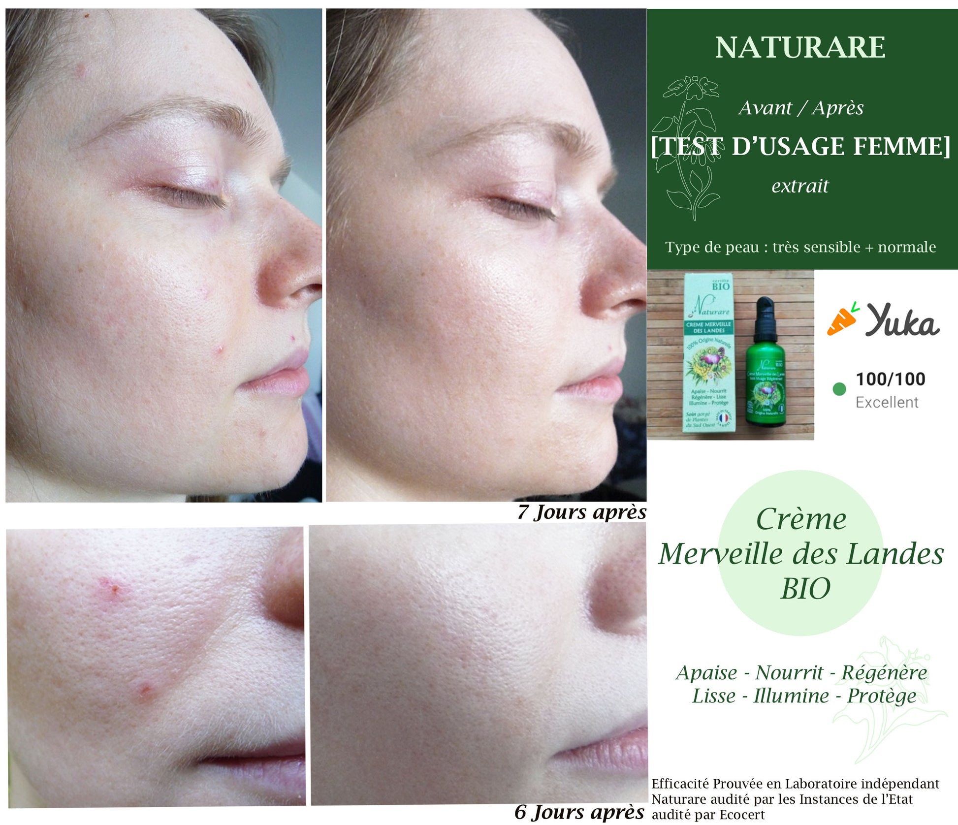 Before and after skin treatment results with Yuka skincare products.